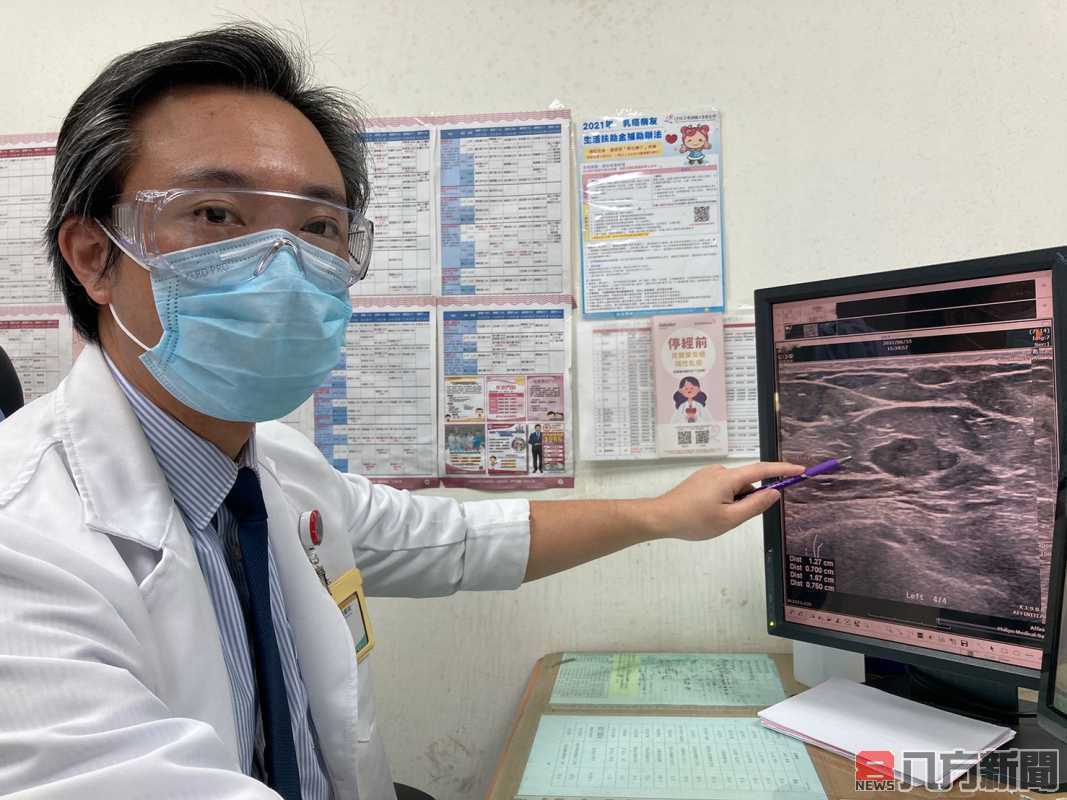 藝人朱芯儀罹患乳癌 醫師籲篩檢重要性
