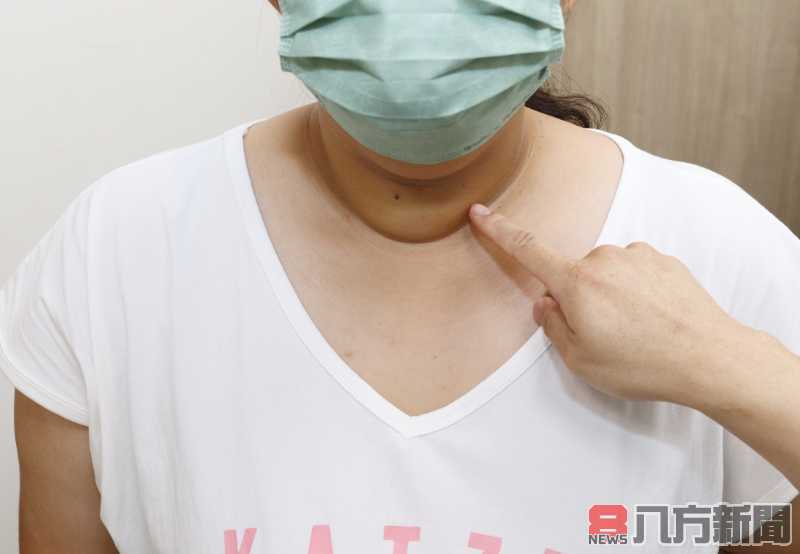 當心！兒童及青少年也有甲狀腺癌
