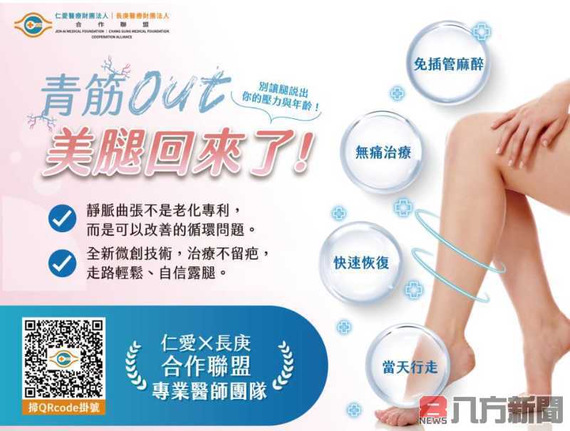 久站造成雙腿腫脹 靜脈曲張微創手術助重返輕盈步伐
